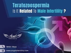 Teratozoospermia | Angels Fertility